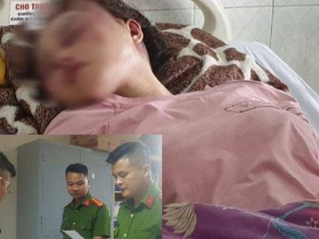 Bắt cán bộ Cục Quản lý thị trường Thanh Hóa đánh bạn gái dã man vì hát song ca với người khác
