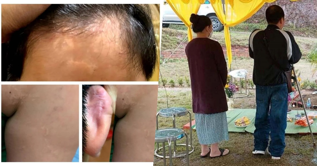 Vụ gửi con đi chữa bệnh nhận về tro cốt: Ám ảnh lời kể của 1 cháu bé 9 tuổi khác ở chung