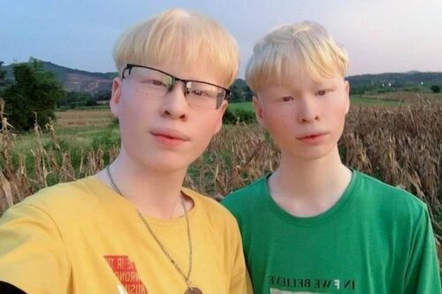 Cặp song sinh Hà Tĩnh từng mặc cảm về ngoại hình: da trắng hồng, tóc mi mày trắng muốt giờ ra sao?