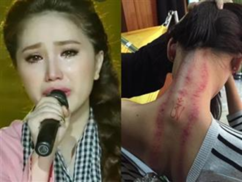 Bảo Thuy lên tiếng về nghi vấn bị hãm hại bằng 'bùa ngải' khi đang ở đỉnh cao sự nghiệp