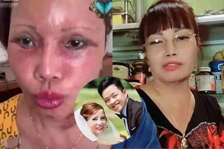 Hiện trạng khó tin của cô dâu Thu Sao sau 3 năm thẩm mỹ