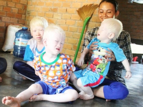 Ba anh em có "vẻ đẹp" độc lạ: Da hồng, mắt đỏ rực