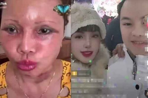 Nhan sắc cô dâu Thu Sao sau 3 năm 'dao kéo' biến chứng