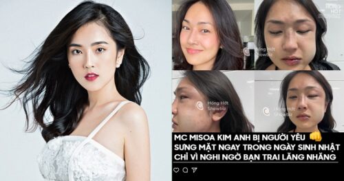 MC 9x nổi tiếng bị bạn trai “tác động” sưng mặt vì nghi ngờ lăng nhăng, nữ chính kêu gọi tẩy chay