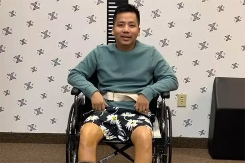 Bất ngờ ngoại hình hiện tại Khoa Pug sau khi chi 5 tỷ kéo dài chân