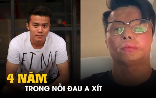 Tâm sự nhói lòng của Việt kiều Canada bị tạt axit, cắt gân chân cách đây 4 năm