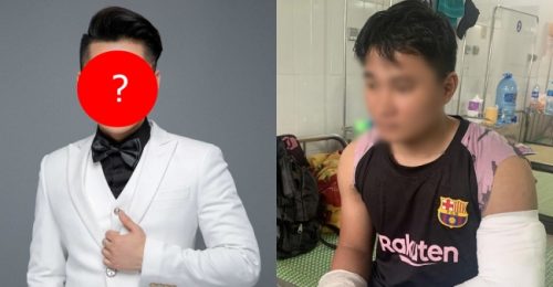 Một sao nam Vbiz ủng hộ ngay 20 triệu đồng giúp nam shipper bị đánh gãy 2 tay