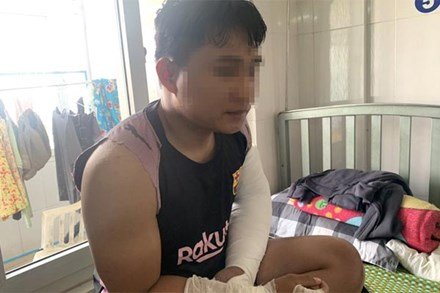 Shipper ở Quảng Ngãi bị người nhận hàng đánh gãy hai tay kể gì?