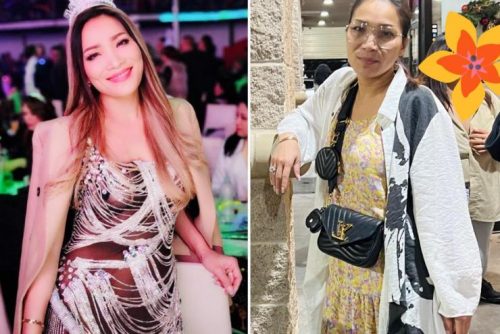 Ca sĩ Hồng Ngọc giờ ra sao sau tai nạn bị bỏng nặng khuôn mặt?