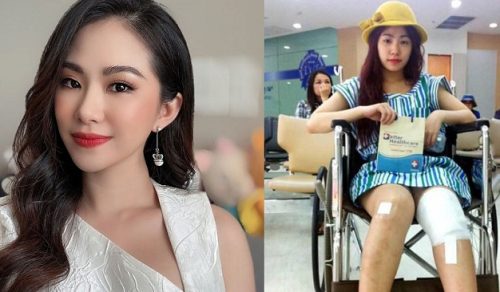 Lương Bích Hữu: Tôi không dám soi gương, ăn cháo trắng suốt 1 năm sau vụ tại nạn