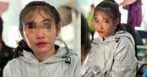 Người mẹ trong vụ ném con từ trên gác xuống đất: Gào khóc xin được gặp con trước khi bị giảm thị lực