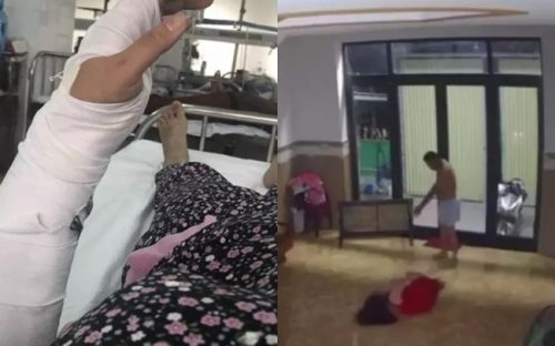 Người phụ nữ bị chồng hành hung ở Đà Nẵng