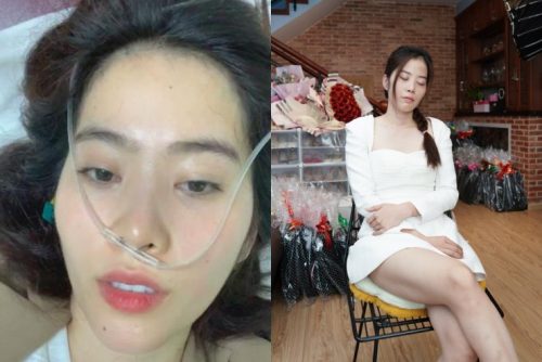 Lộ diện mạo “khó tin” của Nam Em sau khi mắc căn bệnh nguy hiểm hơn cả Hari Won