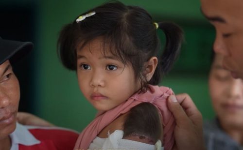 Bé gái 4 tuổi sở hữu cánh tay đầy lông lá, hàng xóm không dám lại gần