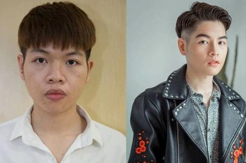 Từng bị ám ảnh ngoại hình nhưng nhờ phẫu thuật thẩm mỹ sự nghiệp của Đức Phúc lên như diều