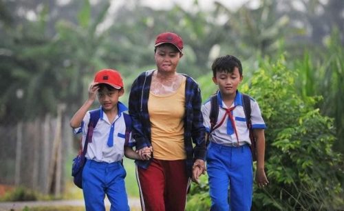 Bất ngờ cuộc sống mới của người phụ nữ Phú Yên bị chồng cũ thiêu sống