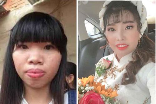 Phượng Thị Nở giờ ra sao sau 6 năm trùng tu nhan sắc