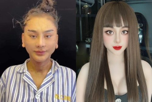 Lâm Khánh Chi lên tiếng sau khi chi 1 tỷ đồng thẩm mỹ bị chê tơi tả