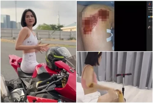 Ngọc Trinh công khai những vết xây xát sau khi ngã mô tô, bị tiến sĩ Đoàn Hương vạch trần