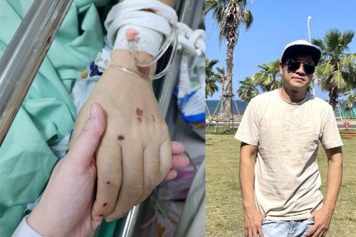 CĐM lo lắng khi ca sĩ Tuấn Dương gặp tai nạn giao thông nghiêm trọng