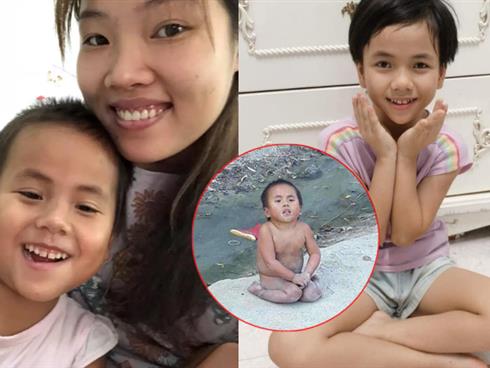 Em bé Mường Lát liệt 2 chân, không mảnh vải che thân ngày nào sắp trở về quê sống cùng bà nội