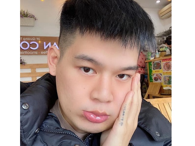 Long Chun bị u xương ác tính ở xương hàm dưới