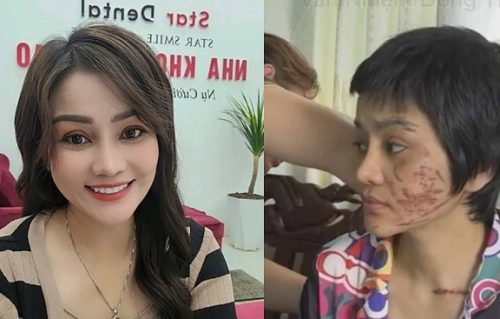 Thai phụ từng bị chồng ra tay như thời trung cổ được Phương Lê giúp đỡ, nay lột xác bất ngờ