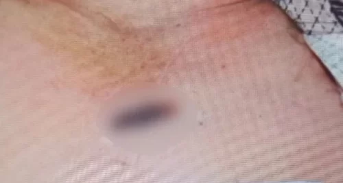 Bình Thuận: Công an mở nắp quan tài khám nghiệm tử thi khi đám tang đang diễn ra