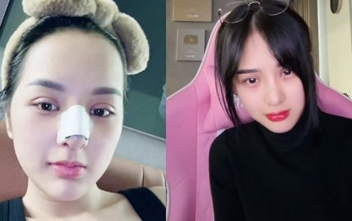 Gấm Kami lộ diện sau khi "dao kéo" nát mặt, nhan sắc ra sao khiến CĐM tiếc nuối?