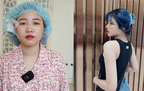 Diệp không chổi: Bị nghi phản bội Soanh, sau khi "dao kéo" liền bỏ rơi bạn trai?