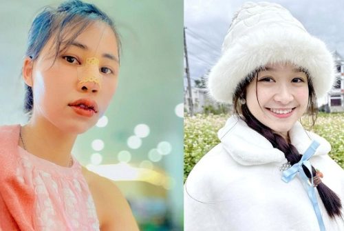 Thơ Nguyễn tiếp tục dao kéo, phá banh hết mũi đến môi, Bảo Ngọc hết đọ nhan sắc?