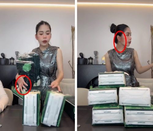 Hằng Du Mục để lộ mặt bị thương trên livestream, dân tình nghi bị chồng tác động