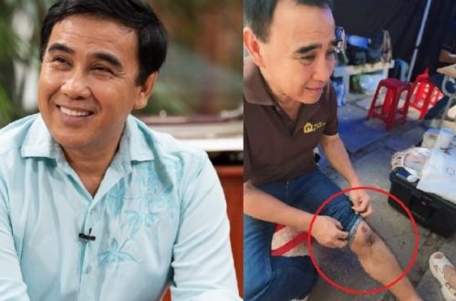Xúc động khi MC Quyền Linh bị tai nạn xe máy vẫn cố làm điều này