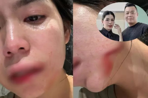 Chồng người TQ có bị bắt sau khi đánh đập Hằng Du Mục?