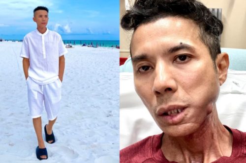 Kasim Hoàng Vũ chính thức lên tiếng về sức khỏe hiện tại, xót xa vì lời xin lỗi