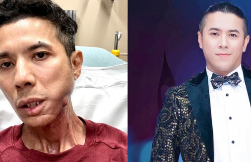 Bạn thân Kasim Hoàng Vũ tiết lộ tình trạng hiện tại của nam ca sĩ khiến fan xót xa