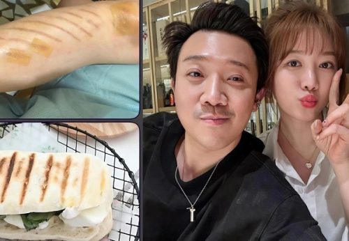 Hari Won flex vết thương hậu sự cố, Trấn Thành đăng đàn khịa, CĐM thích thú