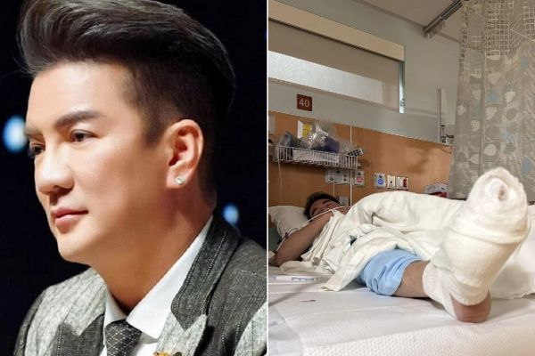 Đàm Vĩnh Hưng một lần nói hết về vết thương ở chân, lộ tình trạng đáng lo ngại