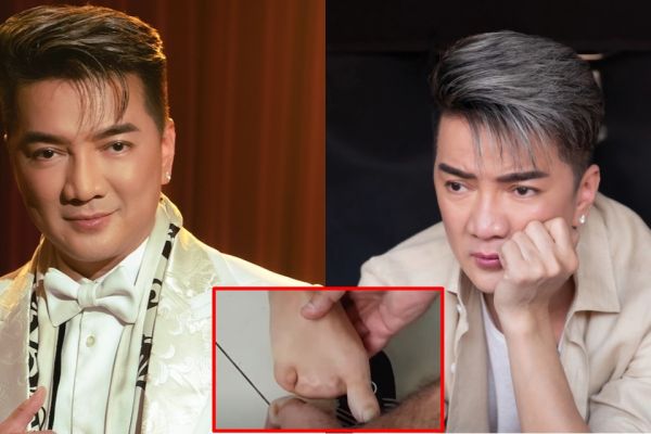 Sự thật bất ngờ về hình ảnh bàn chân 1 ngón được cho là của Đàm Vĩnh Hưng