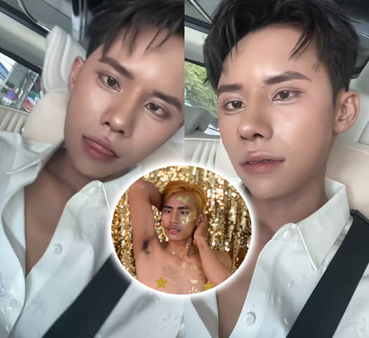 Lai Thai sau khi phẫu thuật thẩm mỹ tại Việt Nam Lai Thai sau khi phẫu thuật thẩm mỹ tại Việt Nam